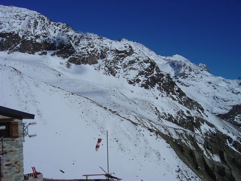dent028