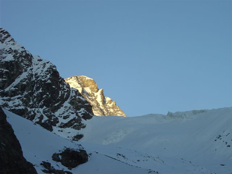 dent031