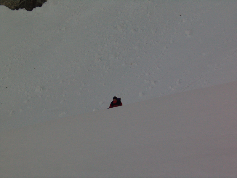 dent042a