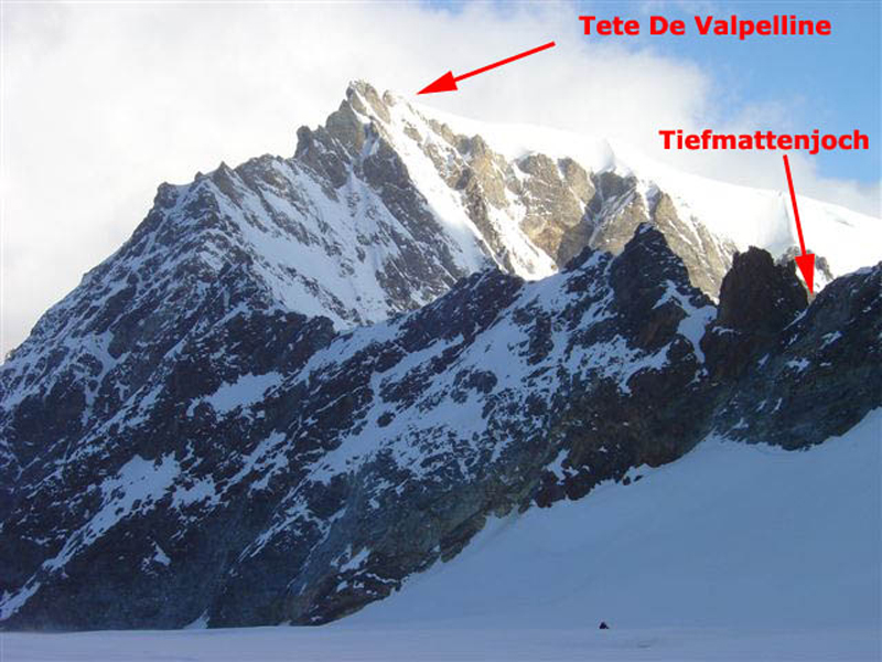 dent058