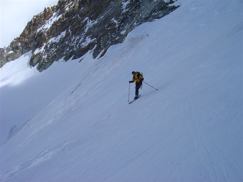 dent075