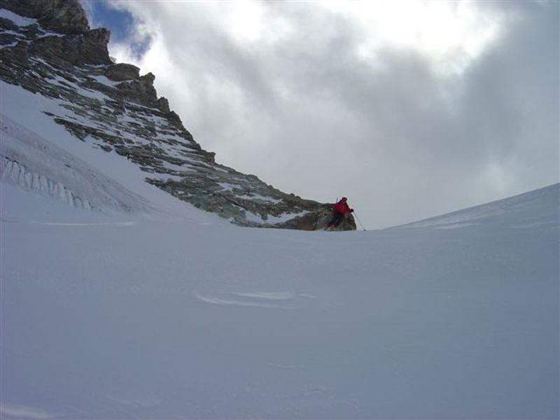 dent080