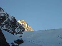 dent031