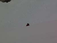 dent042a