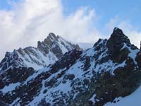 dent056