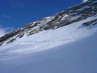 dent064