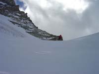 dent080